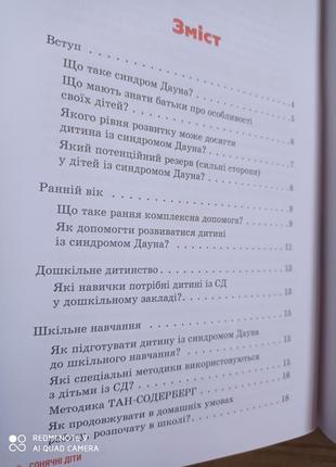 Р8 сонячні діти із синдром дауна чеботарьова4 фото