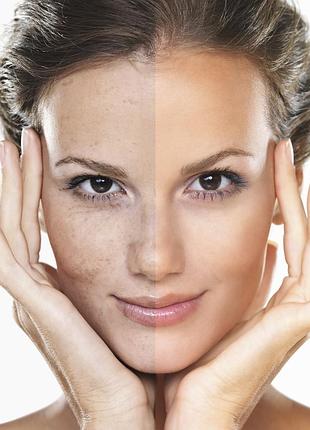 Ночная двухфазная маселка-пилинг для лица lancome absolue precious cells 2