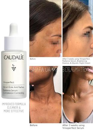 Осветляющая сыворотка против пигментных пятен caudalie vinoperfect radiance correcting serum2 фото