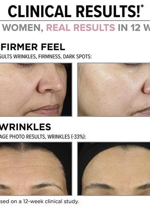 Крем сироватка it cosmetics hello results wrinkle reducing daily retinol serum in cream2 фото