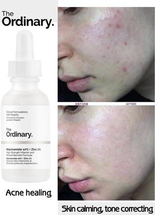 Сироватка для проблемної шкіри the ordinary 10% niacinamide 1% zinc serum ніацинамід цинк проти акне2 фото