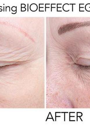 Антивозрастная сыворотка для лица bioeffect egf serum