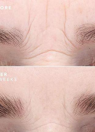 Антивозрастная сыворотка для лица bioeffect egf serum