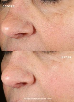 Антивозрастная укрепляющая сыворотка для лица strivectin tightening & brightening face serum3 фото