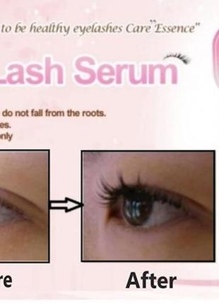 Лечебная сыворотка для ресниц etude house my lash serum2 фото