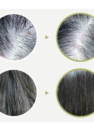 Маска-пилинг для кожи головы с чайным деревом lador tea tree scalp clinic hair pack