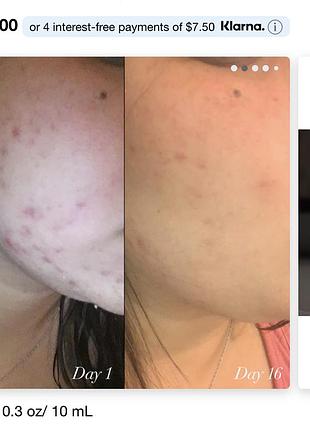 Культовая сыворотка с ретинолом 10 мл shadi darden