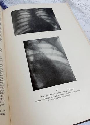 1956 рік! внутрішні хвороби💉🌿 тареєв медицина медгиз ретро вінтаж фізіологічні хвороби лікування4 фото