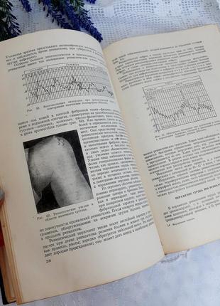 1956 рік! внутрішні хвороби💉🌿 тареєв медицина медгиз ретро вінтаж фізіологічні хвороби лікування5 фото