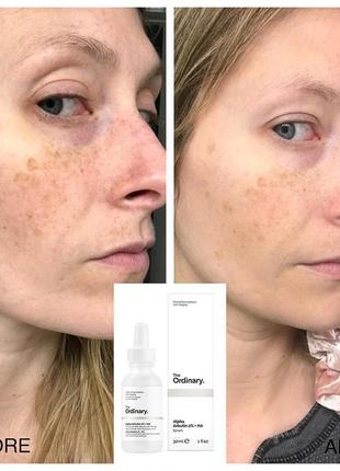 Сироватка для освітлення і проти пігментації the ordinary the ordinary alpha% + ha