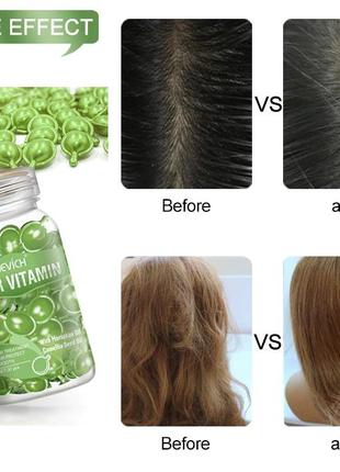 Капсулы для сухих и секущихся волос sevich hair vitamin2 фото