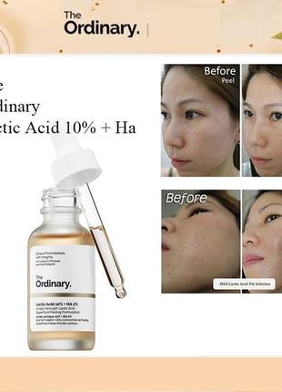 Нежный кислотный пилинг the ordinary lactic acid 10% + ha - 30ml2 фото