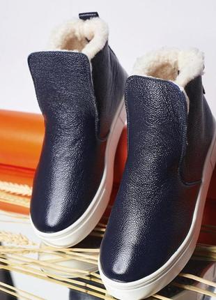 Зимові жіночі високі сліпони черевики з натуральної лакової шкіри на овчині товста підошва 77bm