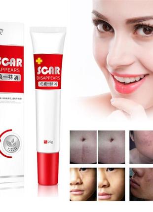 Крем от шрамов рубцов, растяжек, стрий, шрамов от акне, пигментации