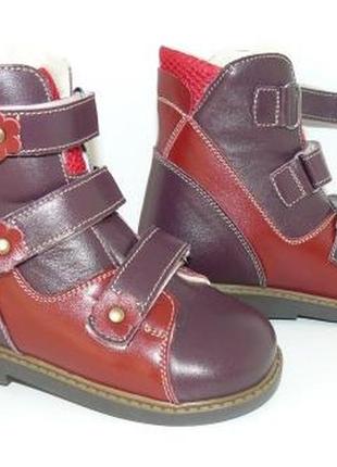 Ортопедичні зимові черевички орто плюс для дівчинки 18 - 41 рр.9 фото