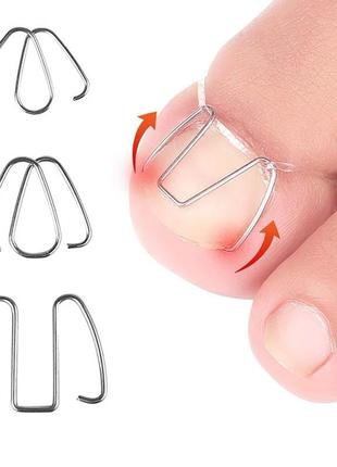 Коректор дротяний на резинці від врослих нігтів (6шт)