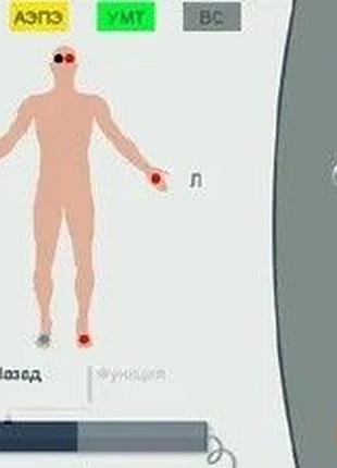Аппарат имедис эксперт 4-го поколения