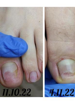 Протигрибковий засіб baehr (mythol forte) 30мл