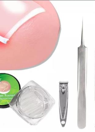Набор для лечения вросшего ногтя