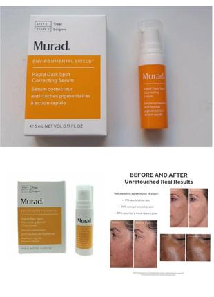 Murad rapid dark spot correcting serum