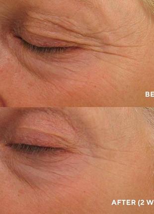 Eye authority – интенсивный лифтинг-крем для век hydropeptide гидропептид3 фото