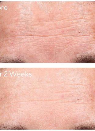 Пробник сыворотки murad retinol youth renewal serum сыворотка для омоложения и восстановления кожи2 фото