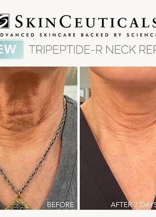 Мощный антивозрастной крем с ретинолом для кожи шеи skinceuticals tripeptide r neck repair2 фото