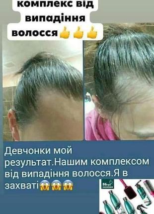 Комплекс проти випадіння волосся hair system3 фото