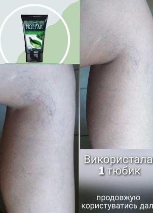 Фітогель для ніг з екстрактом п‘явки "varicostop effect"6 фото