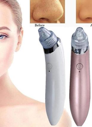 Вакуумний апарат для чищення пор  beauty skin care specialist xn-8030