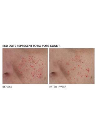 Сироватка для звуження пор dr. dennis gross skincare alpha beta® pore perfecting & refining serum 15 ml2 фото