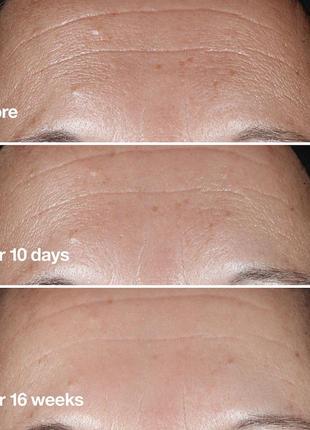 Антивікова сироватка против зморшок clinique smart clinical repair wrinkle correcting serum2 фото