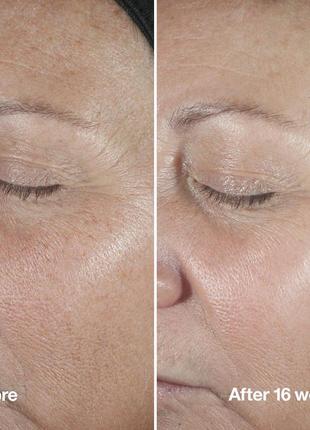 Антивікова сироватка против зморшок clinique smart clinical repair wrinkle correcting serum3 фото