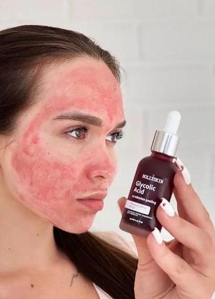 🌹кислотна пілінг-сироватка для обличчя hollyskin glycolic acid5 фото