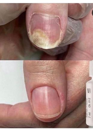 Лікувальне масло для нігтів і шкіри 7мл baehr