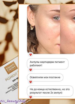 Martiderm pigment zero dsp-bright ампулы для депигментации и сияния кожи2 фото