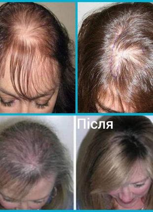 Сироватка-спрей проти випадіння волосся. крок 5