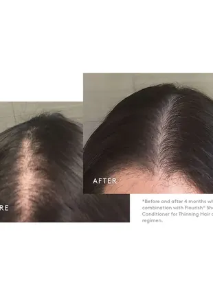 Virtue labs пена против выпадения волос с 5% миноксидил2 фото