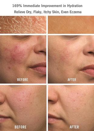 Восстанавливающий увлажняющий крем для сухой кожи fab ultra repair cream first aid beauty2 фото