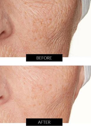 Антивозрастное увлажняющее масло с ферментами для лица lancer omega hydration oil...