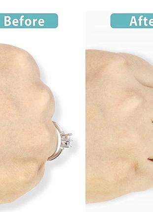 Силіконовий фіксатор для кілець