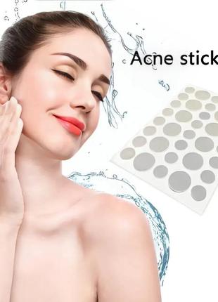Пластырь от прыщей acne patch (72 шт)2 фото