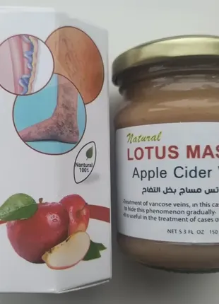 Lotus massage apple cider vinegar мазь від варикозу1 фото