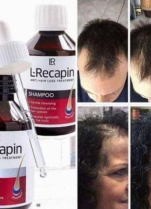 L-recapin шампунь +тонік проти випадіння волосся